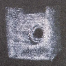 Figure XI
